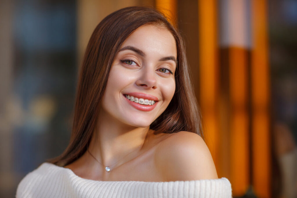 Emotional portrait of a beautiful happy smiling young woman with braces. Attractive girl with bracket system posing in city outdoor. Brace, bracket, dental care, malocclusion, orthodontic health concept. Blurred Details