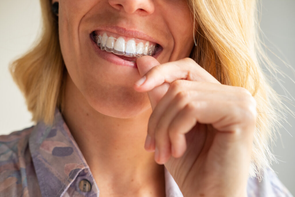 Woman smiling with clear Invisalign aligners for orthodontic treatment